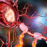 neuron